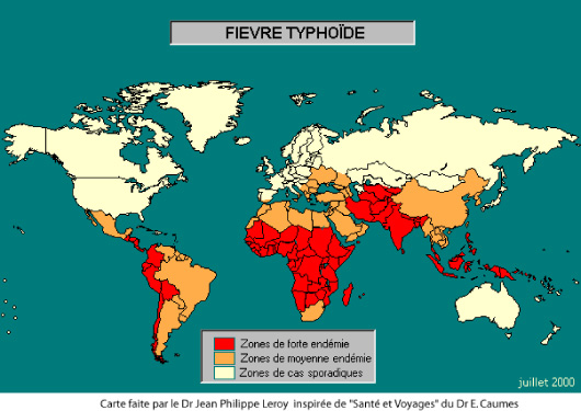 Typhoide